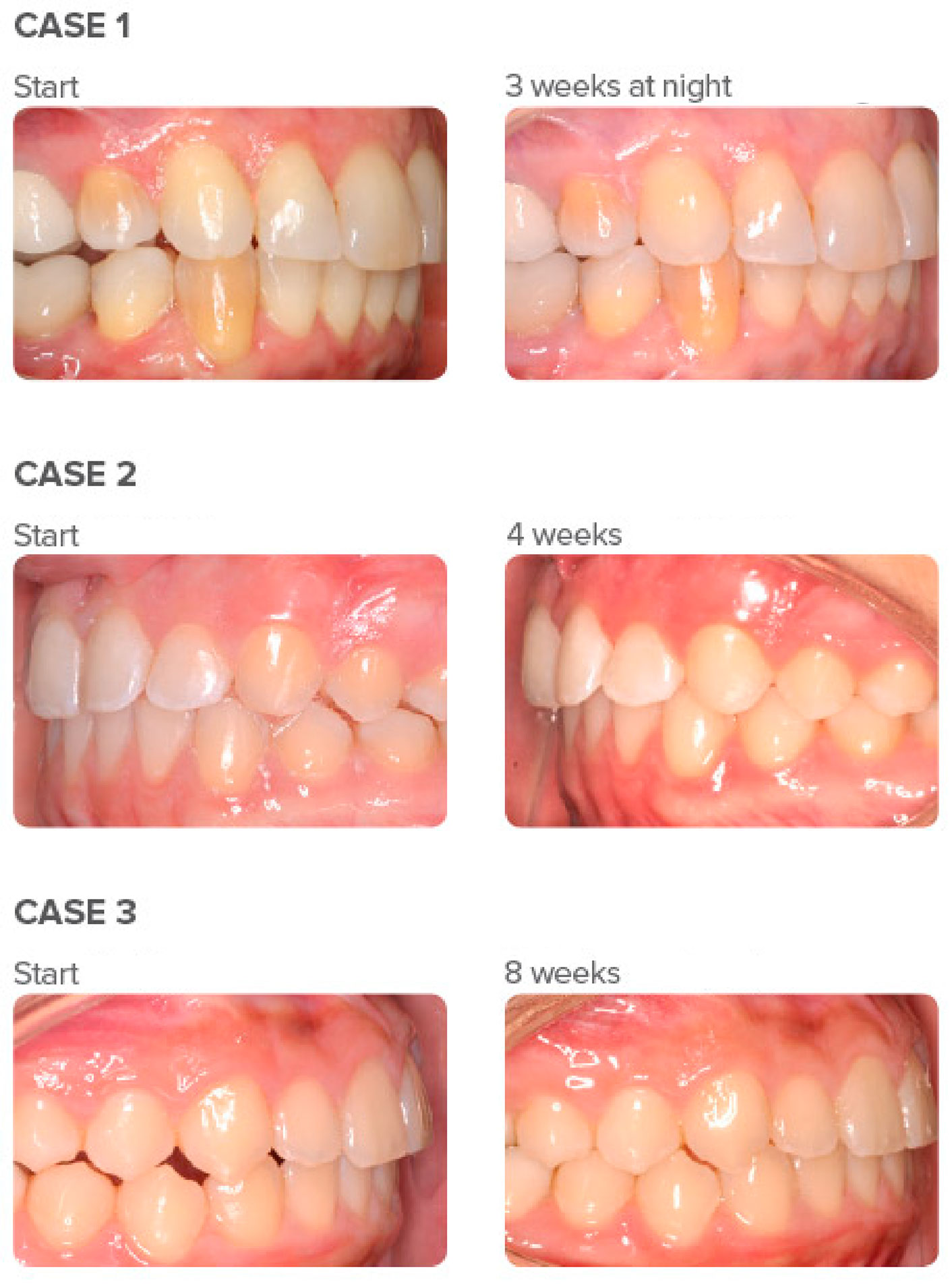 products-ifinisher-results-01