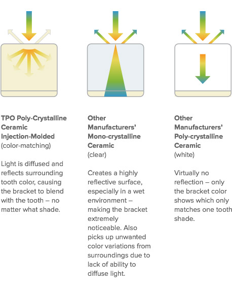 products-pcmt-how-it-works